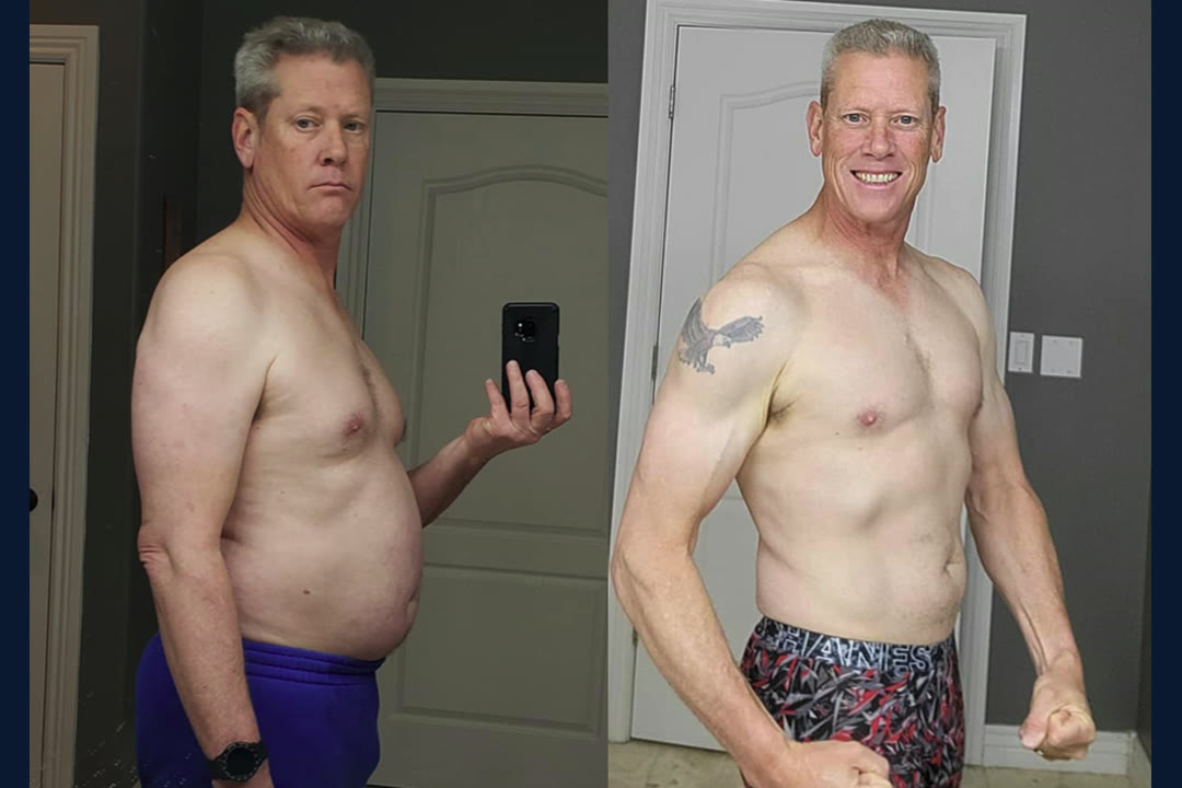Martin R. before and after