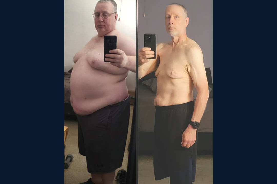 Stephen A. before and after